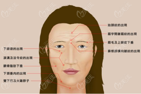 無痕水剝離拉皮有危險(xiǎn)嗎