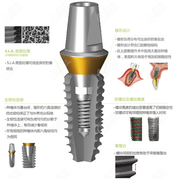 韓國(guó)Neo與登騰及奧齒康哪個(gè)好