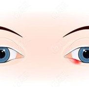 襄陽(yáng)雙眼皮修復(fù)好的醫(yī)院做寬雙眼皮修復(fù)價(jià)格不貴