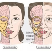 蘭州面部提升手術費用