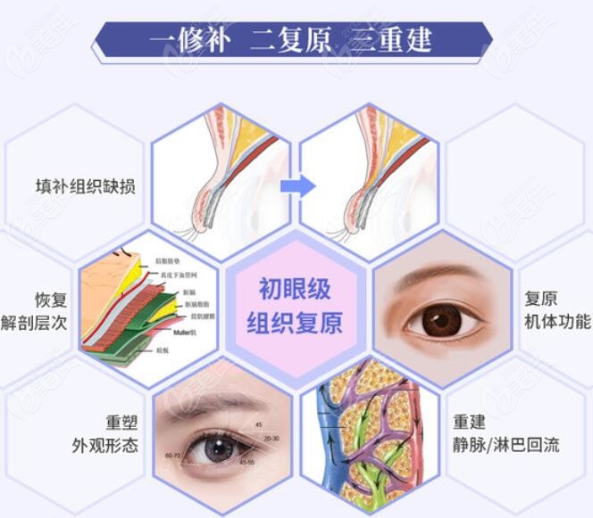 北京师丽丽医生做双眼皮修复技术好吗
