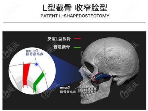 成都有磨骨资质的医院中