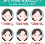 景德鎮(zhèn)割雙眼皮哪家醫(yī)院好
