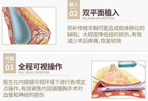 乌鲁木齐丰胸医院排名位列前三的