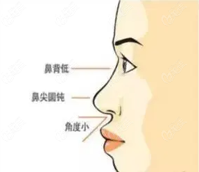 宁波艺星除了卢燕明医生做耳软骨鼻综合好外肖庆华也不错