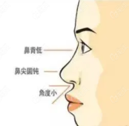 寧波藝星除了盧燕明醫(yī)生做耳軟骨鼻綜合好外肖慶華也不錯
