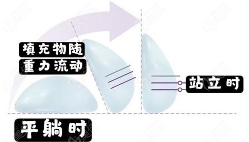 魔滴和傲諾拉絢耀假體相比較的區(qū)別蠻大