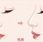 貴陽隆鼻醫(yī)院排名前十強