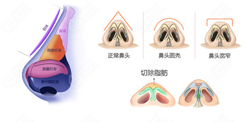 上海叶丽萍做鼻子怎么样呢