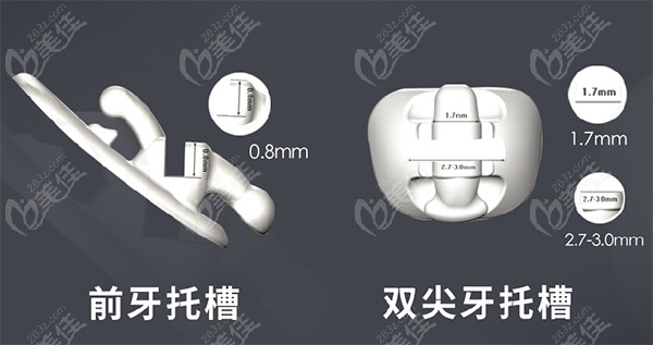 說說Incognito舌側矯正有啥優(yōu)點能使其費用比eBrace貴這么多