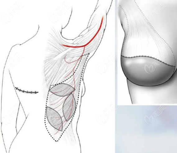 武漢乳房重建醫(yī)院醫(yī)生排名