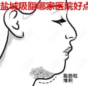 鹽城吸脂哪家醫(yī)院好點(diǎn)