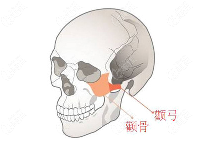 上海顴骨內(nèi)推哪個(gè)醫(yī)生好呢