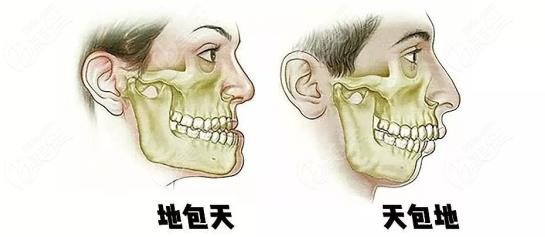 寶雞矯正牙齒大概多少錢