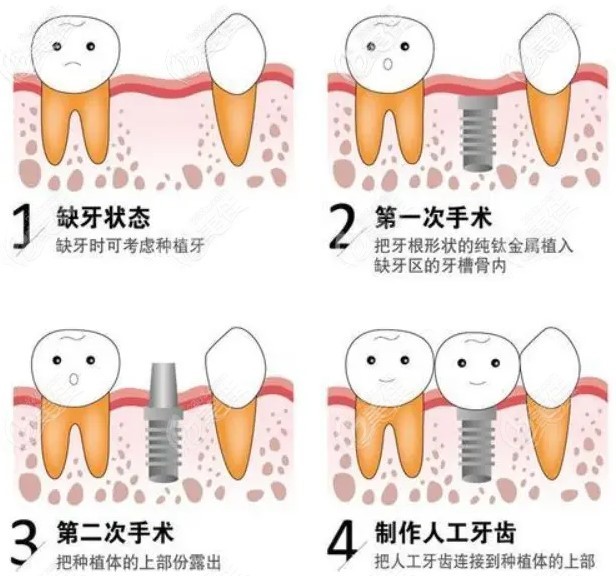 怀化雅贝康口腔价格表