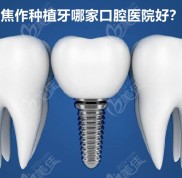 焦作種植牙哪家醫(yī)院好