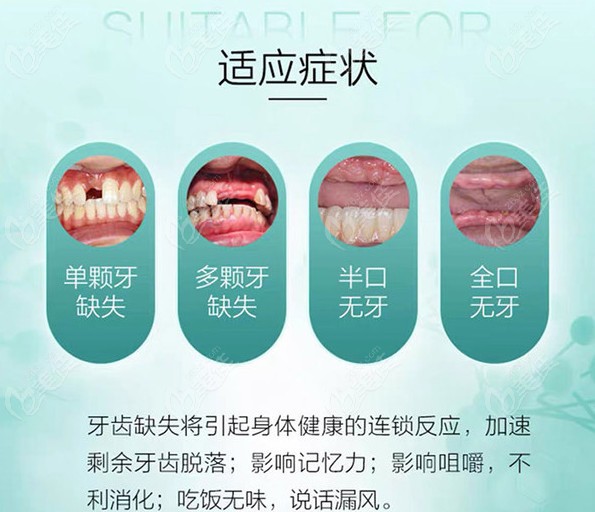 汉中牙科收费标准里竟然有时代天使等隐形牙套价格呦