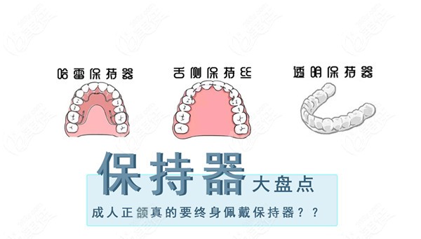 正颌后需要终身佩戴保持器吗