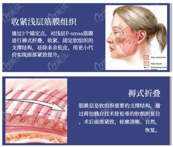 南京拉皮手术多少钱