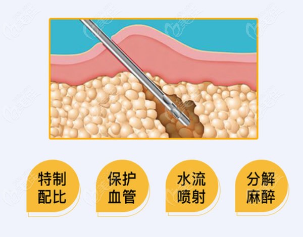 上海美聯(lián)臣醫(yī)院整形價格表