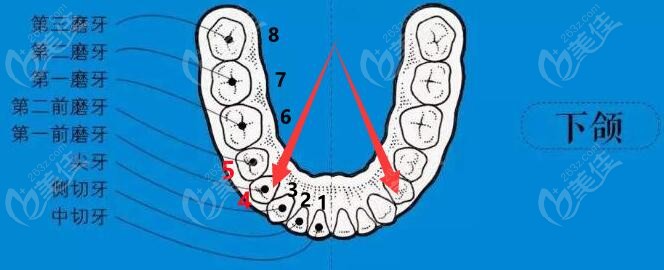 正畸一般拔哪四颗牙