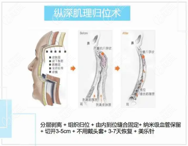 韓國拉皮出名的整形醫(yī)院醫(yī)生