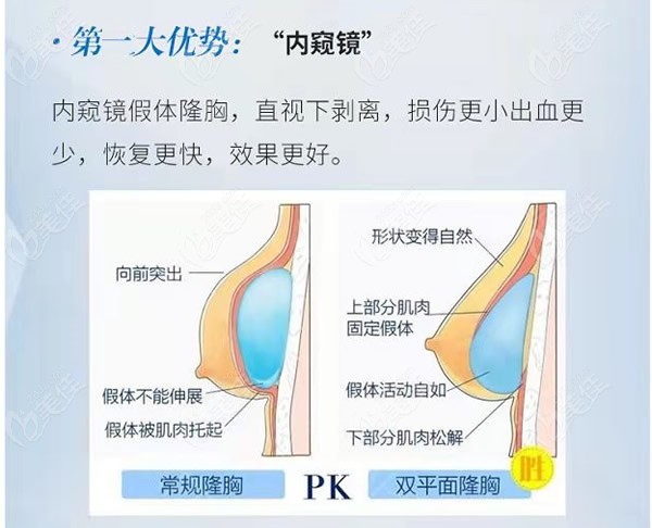 3分钟了解上海唐毅医生隆胸做的怎么样及他胸部下垂提升的口碑