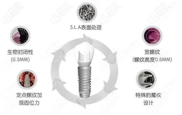 清楚韩国纽百特种植牙的价格是多少钱一颗