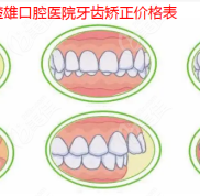 楚雄口腔醫(yī)院牙齒矯正價格表
