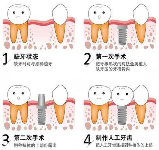 上海口腔医院排名前十名单新鲜出炉