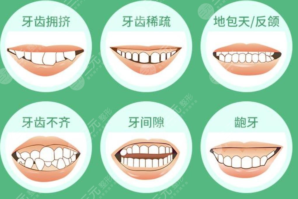 广州牙齿矫正去哪家医院比较好