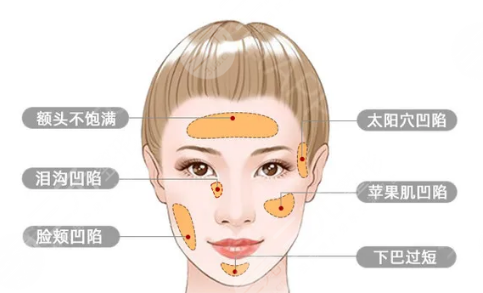 鄭州大學(xué)第二附屬醫(yī)院隆鼻專家王璐、孟寶璽可選