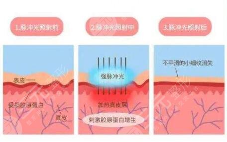 廣州南方醫(yī)院點陣激光醫(yī)生列表