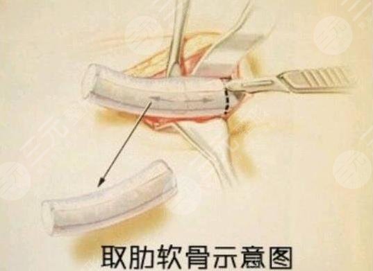 上海东方医院整形外科怎么样