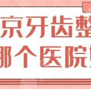 南京牙齒整形哪個醫(yī)院更好