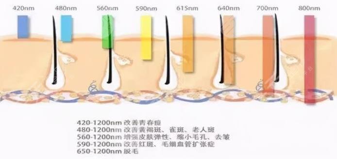 北大深圳医院光子嫩肤多少钱