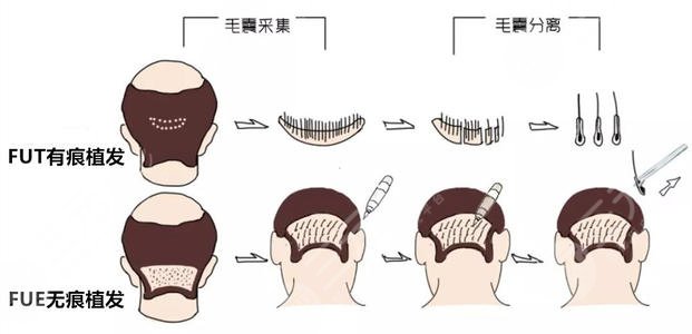 浙江整形医院十大排名名单崭新出炉