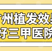 廣州植發(fā)效果好三甲醫(yī)院名單