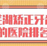 蕪湖矯正牙齒的醫(yī)院排名名單