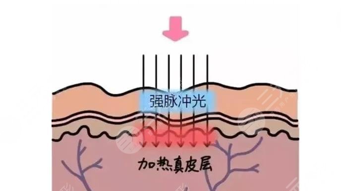 廣醫(yī)二院激光美容中心如何