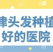 天津頭發(fā)種植術(shù)好的醫(yī)院名單