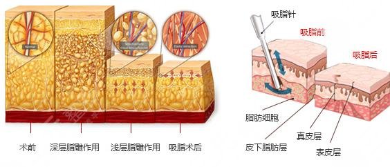 鄭州整形醫(yī)院正規(guī)醫(yī)院