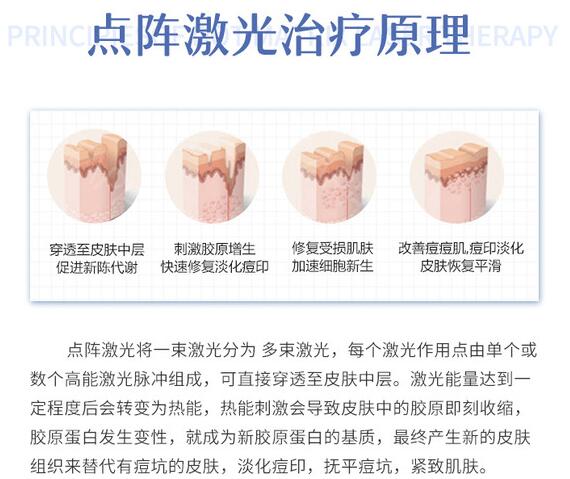 湖南省人民医院点阵激光技术怎么样