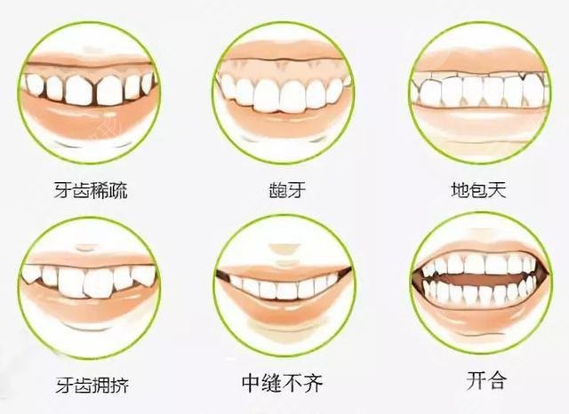 香港大学深圳医院牙齿矫正多少钱