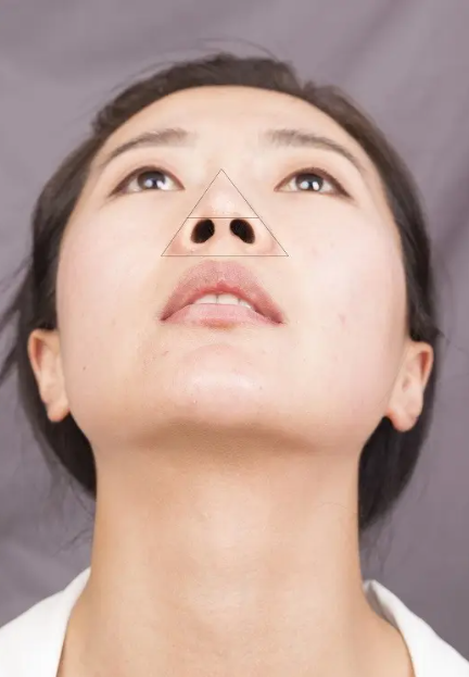 重庆隆鼻医生做的比较自然的有哪些？