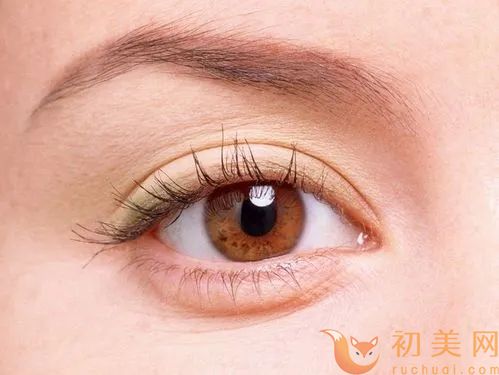 上海眼睛整形
