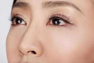 郑州做双眼皮修复较好的医生有哪些？