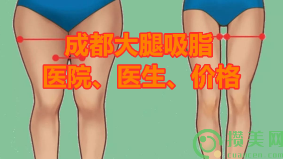 成都大腿吸脂