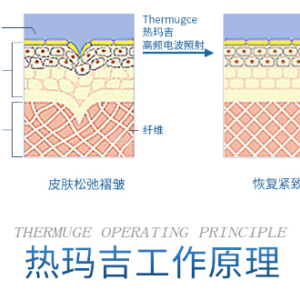 谈谈热玛吉有什么效果和副作用，希望能帮助到想要做热玛吉的你!