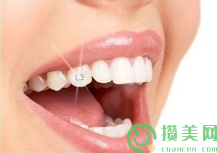 2023年上海市牙齿镶钻术口腔完整价格表-上海市牙齿镶钻术均价为：28192元